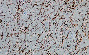 Myelin