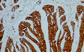 Myosin Heavy Chain 11