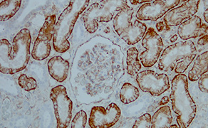Cadherin-6