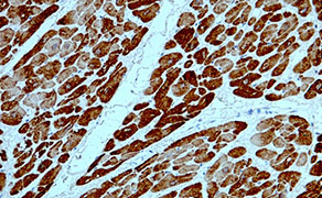 Myosin Light Chain 2