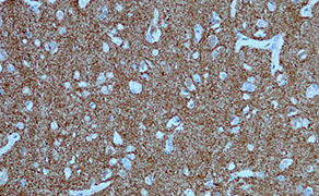 Neurofilament
