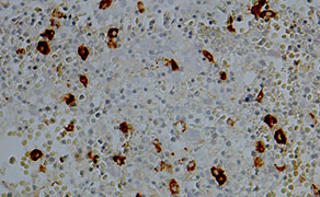 Neutrophil Elastase