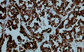 Calcitonin