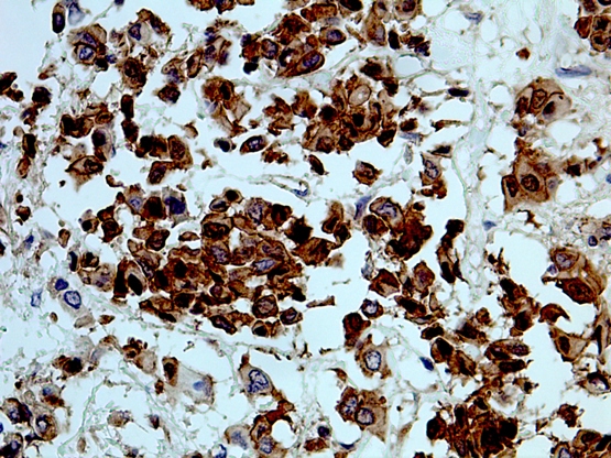 p120 Catenin