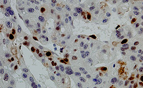 PCNA