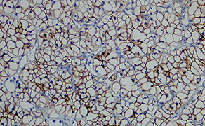 Carbonic Anhydrase 9