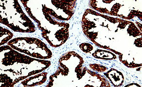 Prostate-Specific Antigen (PSA)