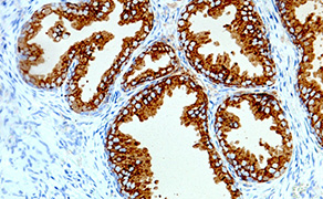 Prostatic Acid Phosphatase