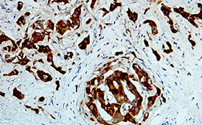 Cathepsin D