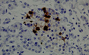 Somatostatin