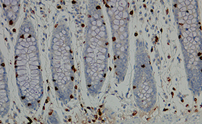 CD103