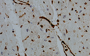Thrombomodulin