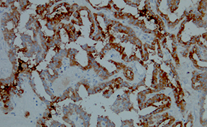 Thyroglobulin