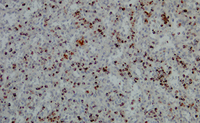 TIA1