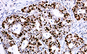 Topoisomerase II alpha
