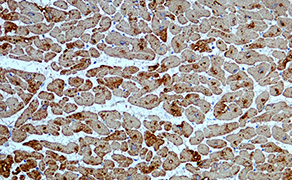 Troponin I, Cardiac Muscle