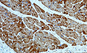 Troponin T, Cardiac Muscle (TNNT2)
