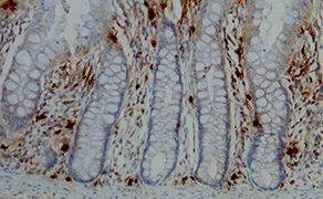 Tryptase