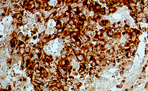 Tyrosinase