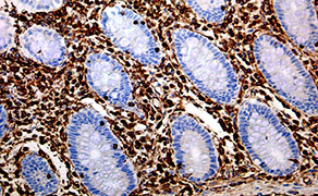 Vimentin