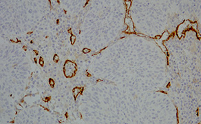 CD105
