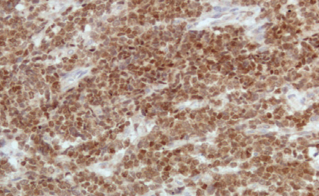 DAX-1 (NR0B1)