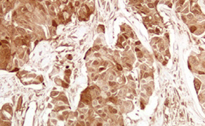 4E-BP1