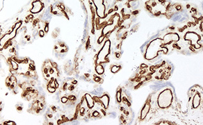 Caveolin-1