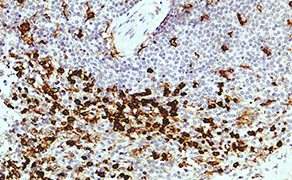 CD11b