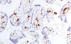 CD163