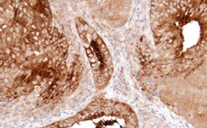Human Epididymis Protein 4