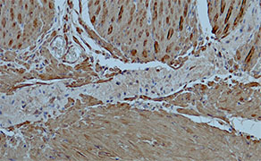 Alpha-Actin