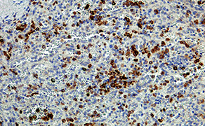 CD13