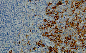 CD138