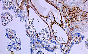 CD146
