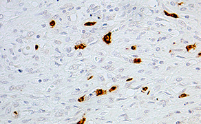 CD15