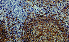 CD20 C-term