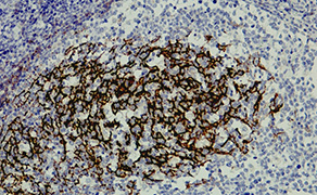 CD23