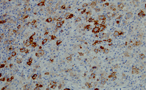 CD25