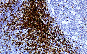 CD3