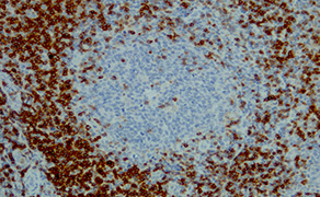 CD3 delta