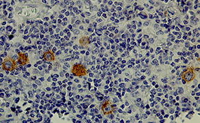 CD30