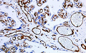 CD31