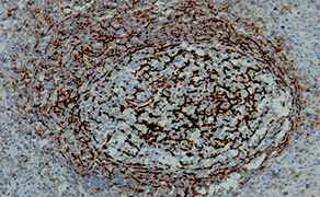 CD35