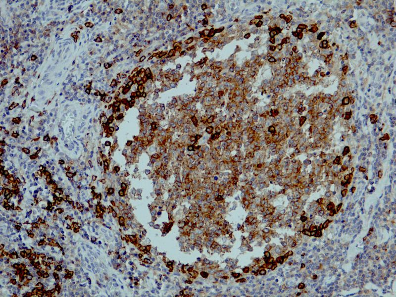 CD38