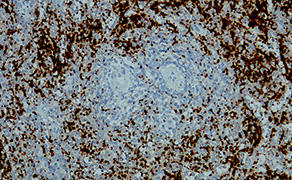 CD41/Integrin alpha 2b