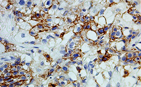 CD44