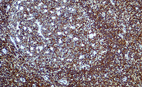 CD45