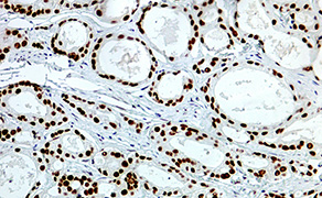 Androgen Receptor