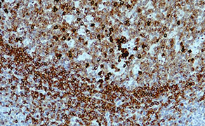 CD79a